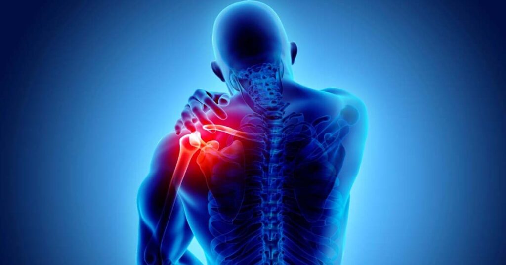 Xray Style image depicting Chronic Shoulder and Back Pain Types
